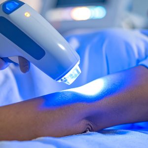 Soins épilation Somone